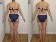 カプリス(CAPRiCE)/リンパドレナージュ