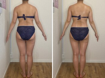 カプリス(CAPRiCE)/リンパドレナージュ