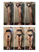 ボーレーヴ 表参道店(beaureve)/ブライダルインディバ（90分）