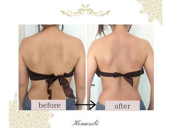 コモレビ(Komorebi)/