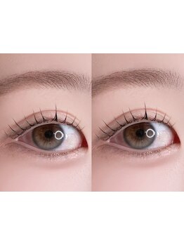 まつげのお悩み解決サロン