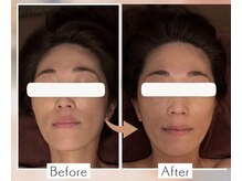 ローズボディ 恵比寿店の雰囲気（【小顔矯正＆首肩リンパ】巻き肩歪み整え、スッキリ1度で小顔へ）