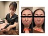 【当店人気No.1/たるみ】毛穴徹底洗浄＋最新機器エイジングケア90分 ￥15000