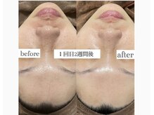 アンドエスビューティ(&S Beauty)/