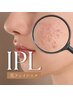 【男・女/IPL光フェイシャル】しみにお悩みの方へ！美肌管理