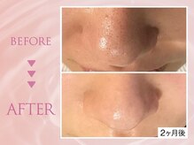 クリアラボ 池袋(Clear Lab)/韓国肌管理&毛穴洗浄専門店