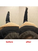 ナオル整体 福岡香椎院(NAORU整体)/50代男性施術事例【股関節】