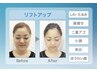 【最新超リフトアップ！！】幹細胞ケア付でエステ超えとリピーター様続出！！