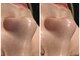 ティア(TIA)の写真