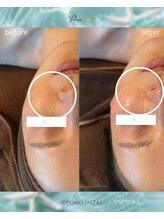 ポノ(Pono)/一回の施術効果☆