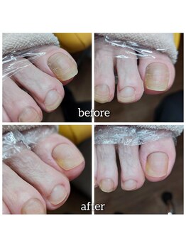 爪切り屋 足楽/