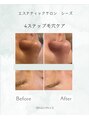 エステティックサロン シーズ&nbsp;#毛穴ケア#肌荒れ＃マッサージ