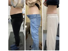 整体院トトノエル 西川原院の雰囲気（産後1ヶ月が過ぎたら骨盤矯正可能です！-10cmの方も多数！）