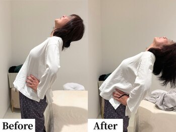 ソレア(Solea)/腰痛改善1回目