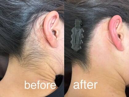 エフ ワクシングブティック(efu.WaxingBoutique)の写真