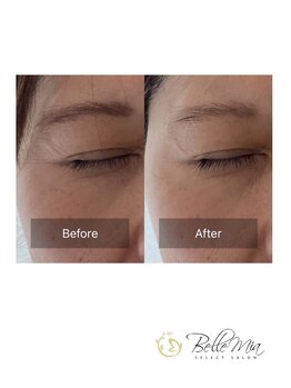 ベルミア(Bellemia)/アイチエイジング!