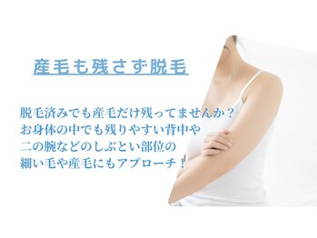 ディオーネ 町田店(Dione)/仕上がりに感動！産毛脱毛