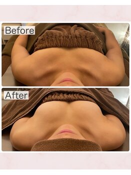 ビジョイ(Bejoy)/バストコース　BeforeAfter