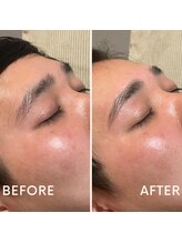 サロン カレア(Salon Kalea)/ハリウッドブロウリフト