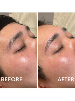 サロン カレア(Salon Kalea)/ハリウッドブロウリフト