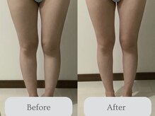 エミィ(emmy)の雰囲気（疲れやすい・浮腫みやすい方に新感覚ツリーケア）