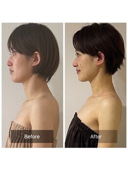 ヴィクトリアサロン(VICTORIA SALON)/まるで別人なお顔に