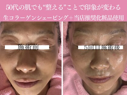 アイリスの写真