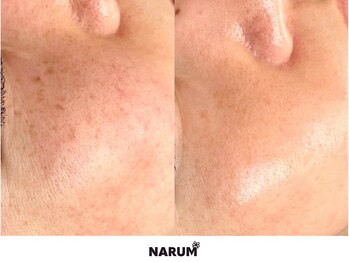 ナルムフェイシャル 代々木(NARUM facial)/