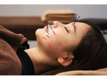 バリューネクスト 青葉台の写真/【極限の技】内側からキレイに美容鍼オーダーメイド！東洋医学に基づく贅沢全身/リフトUPお顔に自信！