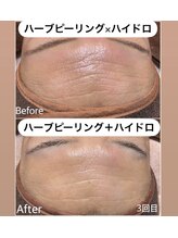 ケーナインエッセ(K9 esse)/ハーブ＋スノー＋ハイドロ