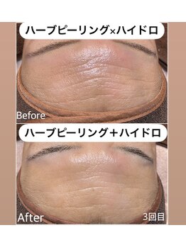 ケーナインエッセ(K9 esse)/ハーブ＋スノー＋ハイドロ