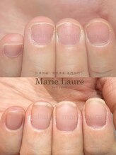 マリーロール 梅田店(Marie Laure)/深爪改善/自爪育成/ネイルケア
