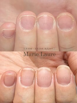 マリーロール 梅田店(Marie Laure)/深爪改善/自爪育成/ネイルケア