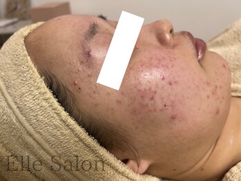 エル(Elle)/before