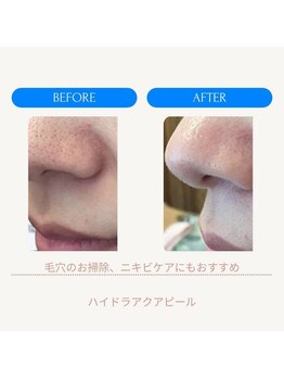 ムーンライズ(moonrise)/