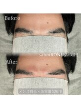 サロンロン 横浜関内(SALON RON)/メンズ眉毛30分/美容電気脱毛