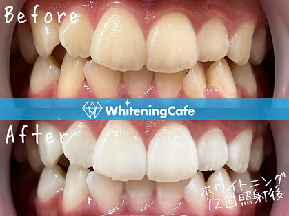 ホワイトニングカフェ 立川店(WhiteningCafe)の写真