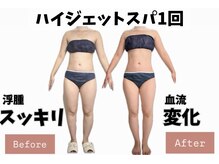 ヨサパーク ポノン(YOSA PARK ponon)/【Before→After】ハイジェット