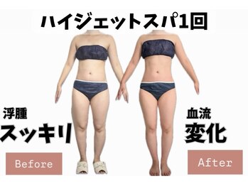 ヨサパーク ポノン(YOSA PARK ponon)/【Before→After】ハイジェット