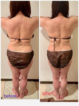 フーガ 宇都宮店(fu-ga)/やみつき 美骨リンパマッサージ