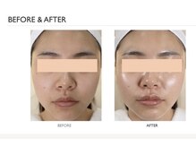 アルメ(Alume)/水光つや玉うるおいケア