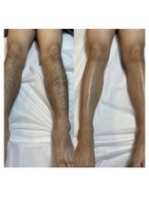 カナウ(KANAU) 人気No.1 全身脱毛