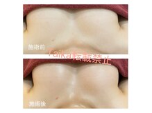 タイカ(Taika)の雰囲気(【最大3cupUP!バスト悩み実績】ふわもち♪バストに変身★)