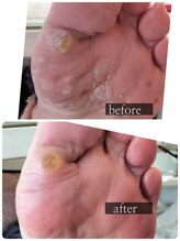 シーエスネイル 元住吉店(CS NAIL)/足裏角質ケアコース♪