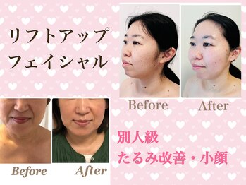 ゆずり葉/４０代からのたるみ改善