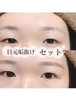 ソプラ 京都駅前店(sopra)/目元垢抜けセット