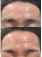 ルモア(Lumor)/メンズ｜清潔感UP！ストレート