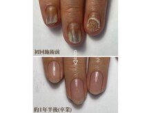 トラブルネイル