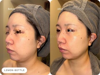 キュレイテッドスキン(CURATED SKIN)/