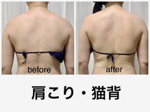 ミュー(Mieux)/背中を整えて、若見え美背中！